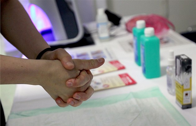 Loni tři, letos už 143. Případů žloutenky v Ústeckém kraji prudce přibylo