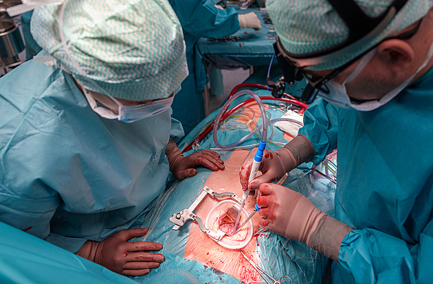 Šetrný způsob náhrady srdeční chlopně. V Olomouci už pacienta otevírat nemusejí