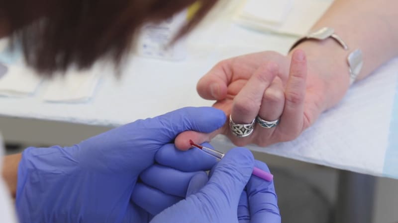 Žloutence loni podlehlo 36 Čechů, zejména mužů. Experti očekávají další nárůst počtu případů