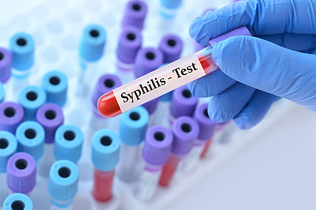 Evropu děsí hantavirus, ale co syfilis? Čísla pohlavních nemocí lámou rekordy